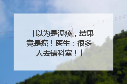 以为是湿疹，结果竟是癌！医生：很多人去错科室！
